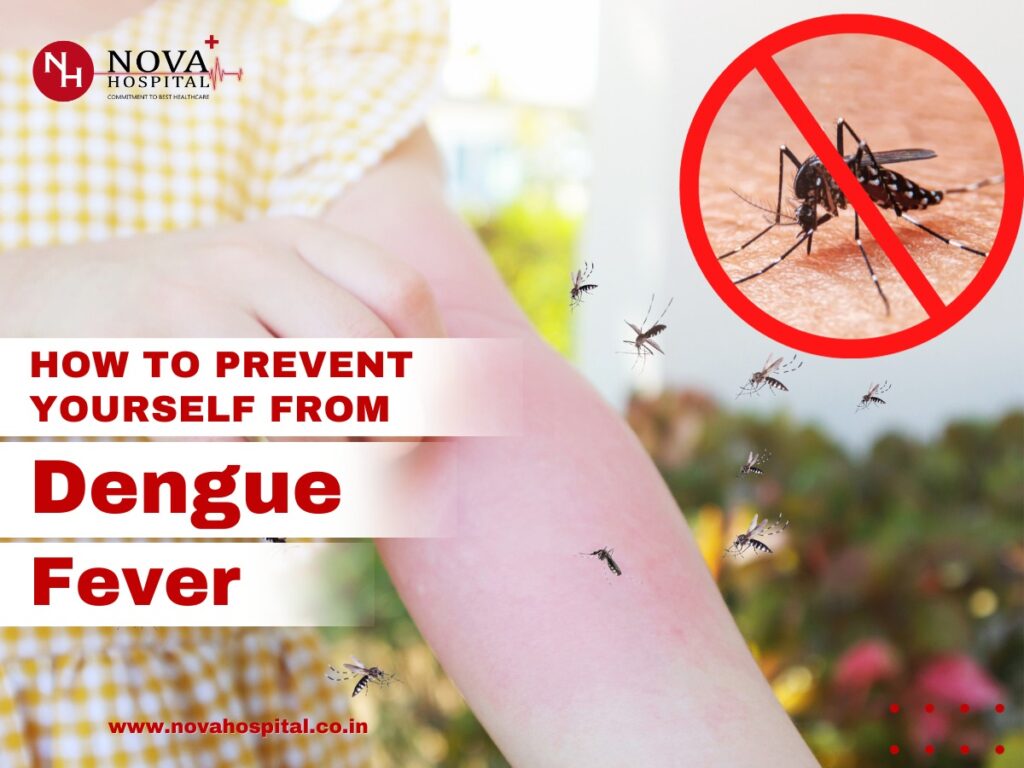 How to Prevent Yourself From Dengue Fever - Nova Hospital