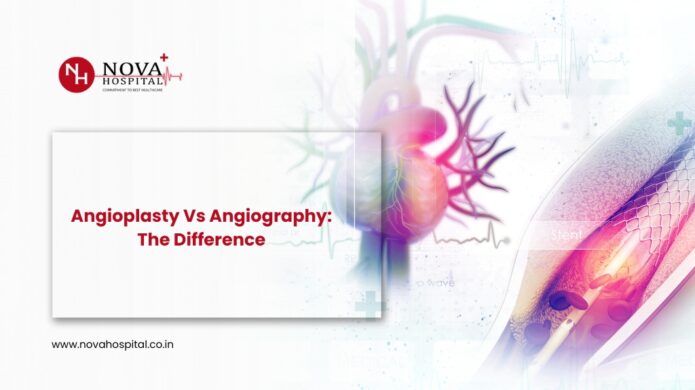 Angioplasty vs. Angiography